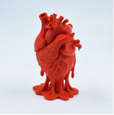 3D printed medical model